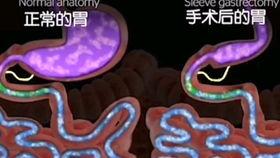 胃视频,胃视频深度解析