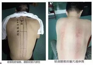 刮痧基本手法视频,轻松掌握养生保健技巧