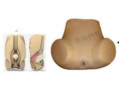 后穹窿穿刺视频